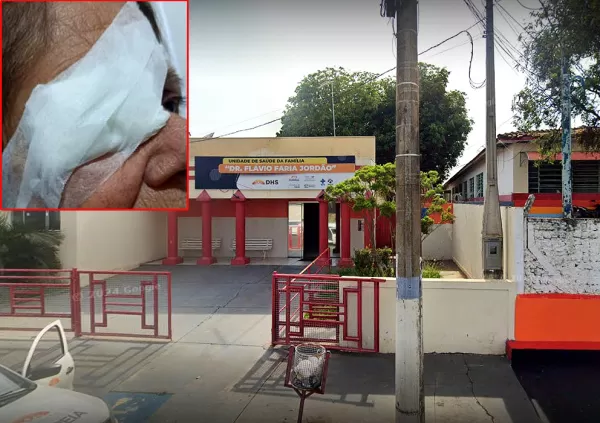 Servidora pública é acusada de jogar querosene no rosto de colega em unidade de saúde