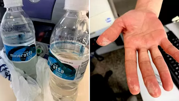 Laudo aponta presença de ácido na garrafa de água consumida por homem que sofreu intoxicação