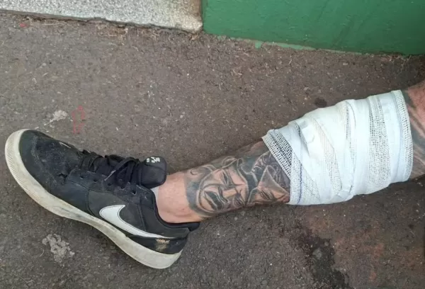 Vidro colocado em saco de lixo deixa mais um coletor ferido. Veja como fazer o descarte correto desse tipo de material 