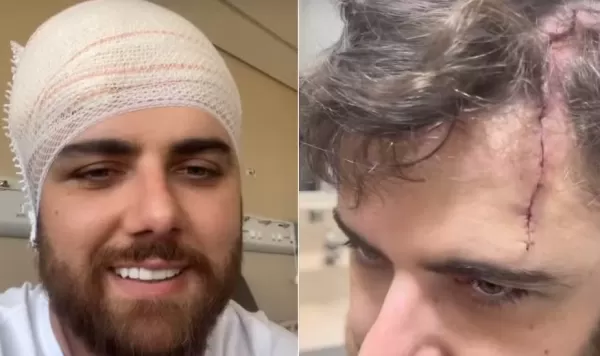 Sertanejo Zé Neto mostra corte na cabeça após acidente com quadriciclo