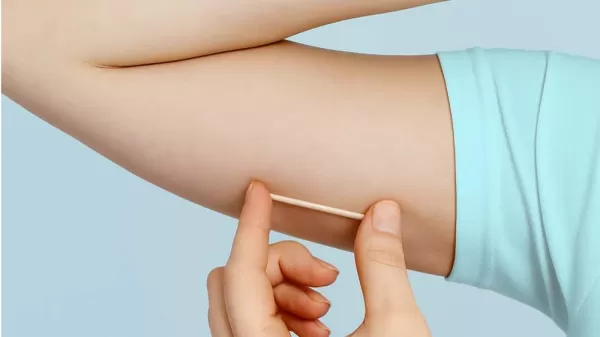 Método contraceptivo válido por três anos está disponível na rede municipal de Saúde de Marília