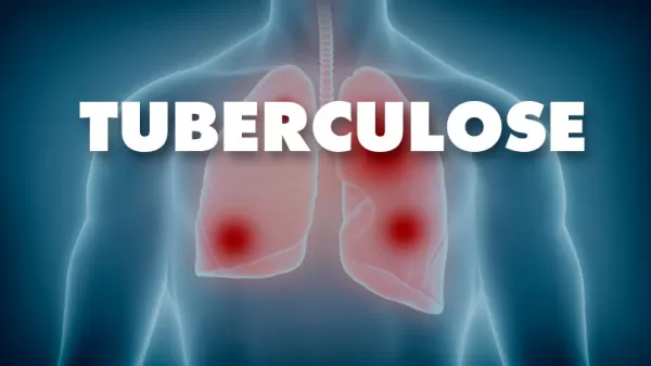 Garça realiza campanha de busca ativa de doenças respiratórias