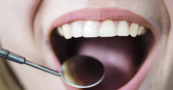 Doença periodontal é a principal causa de perda dos dentes em adultos, revela levantamento da USP