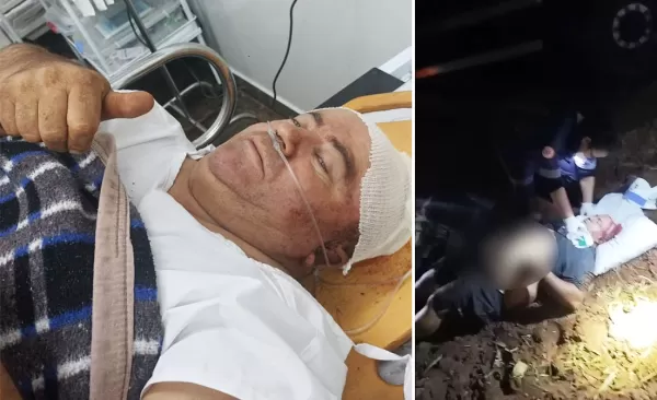 Amigos fazem campanha para ajudar caminhoneiro de Vera Cruz que sofreu grave acidente