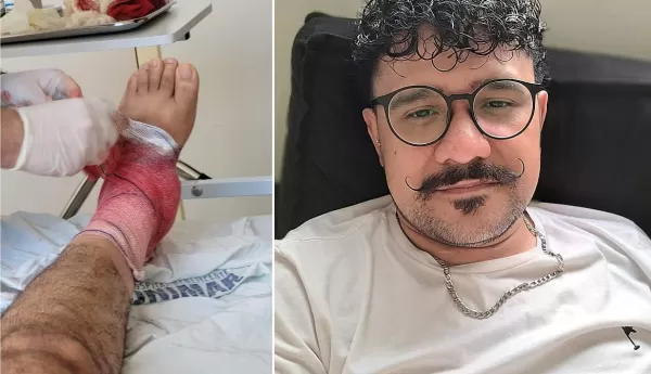 Morador de Marília faz campanha para conseguir prótese e voltar a andar após 11 anos de muito sofrimento