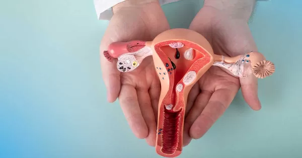 Endometriose afeta mais de sete milhões de brasileiras e desafia o diagnóstico precoce