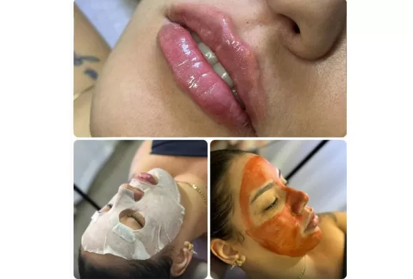 15% off – Clínica da enfermeira esteta Eduarda Mazalli faz aniversário com descontos para comerciários