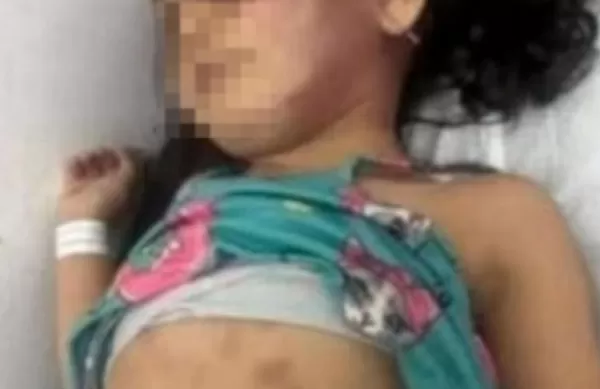 Polícia Civil pede prisão de mãe e padrasto suspeitos de torturar criança de três anos
