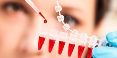 “Plástica interna” usa sangue de jovens para rejuvenescer