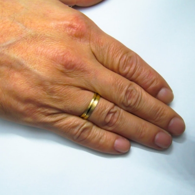 Jovem é baleado em assalto por não conseguir tirar a aliança do dedo