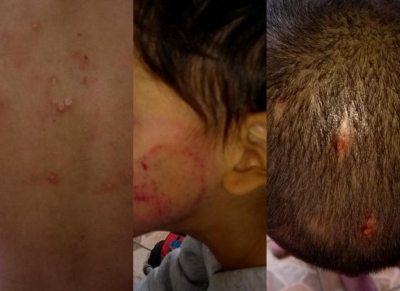 Crianças com sinais de tortura são resgatadas. Tios responsáveis por elas estão foragidos