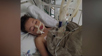 Criança de 4 anos perde fala e movimentos após engasgar com comprimido