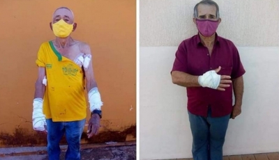 Pitbull escapa de casa, ataca três pessoas na rua e é morto por policial militar 