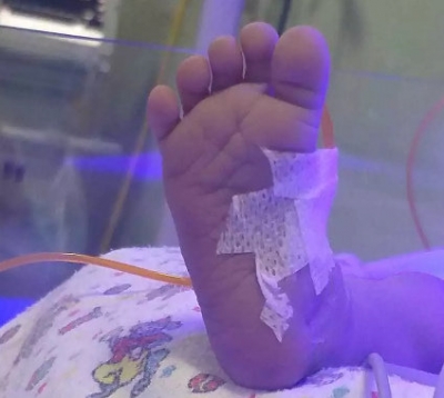 Bebê de 6 meses é intubada e corre risco de vida após suposta agressão dos pais