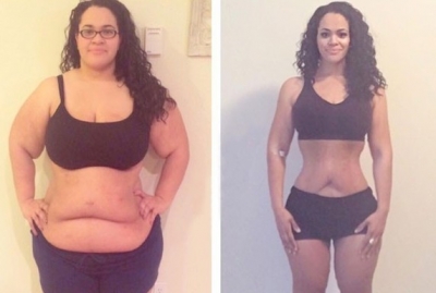 Após vencer câncer no útero, jovem perde 82 kg e faz sucesso na web