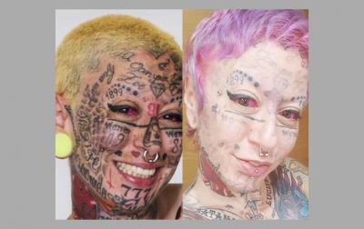 Mulher com mais tatuagens no rosto decide retirá-las