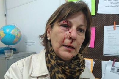 Professora é agredida com socos após repreender aluno de 15 anos