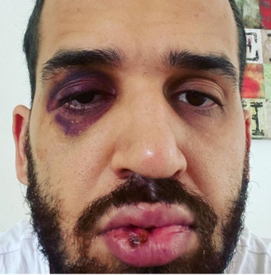 Médico é agredido por alertar sobre a Covid-19; 