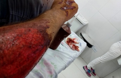 PM fica ferido ao ser atropelado por carro durante abordagem, na região