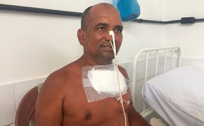 Homem se engasga com dentadura e precisa passar por cirurgia