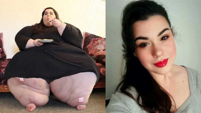 Com quase 300 kg, jovem faz mudanças de hábitos e term vida nova