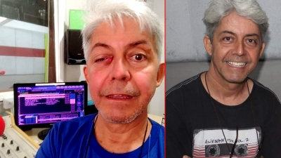 Radialista mariliense pede ajuda para realizar nova cirurgia