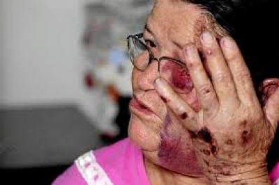 Motorista de carro de luxo que arrastou vendedora de balões é condenado 