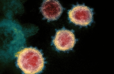 Mulher é infectada por três vírus ao mesmo tempo: coronavírus, influenza e adenovírus