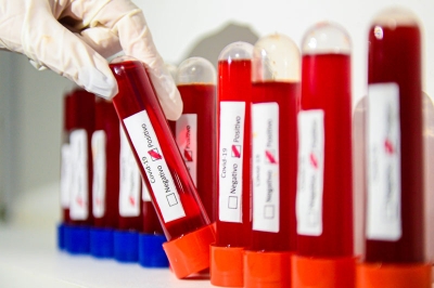 Covid-19: Brasil registra 67.860 novos casos confirmados em 24h