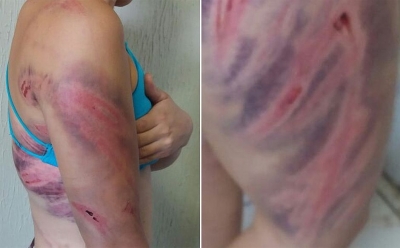 Mulher é agredida pelo marido com mangueira de gás 