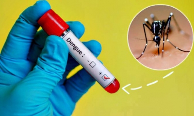 Testes rápidos para dengue e chikungunya são incluídos na tabela do SUS