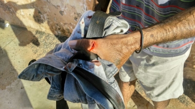 Embriagado, homem mata a paulada e depois atea fogo no próprio cachorro