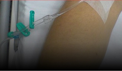 Filha mata pai com veneno para carrapato em visita à UTI