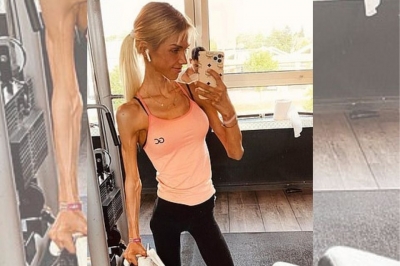 Jovem que relatou luta contra anorexia nas redes sociais morre aos 24 anos