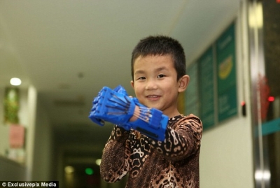 Chinês ganha prótese 3D no Dia das Crianças