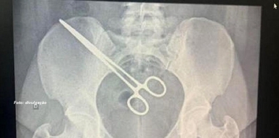 Mulher vai visitar marido na cadeia e descobre que tinha uma pinça 