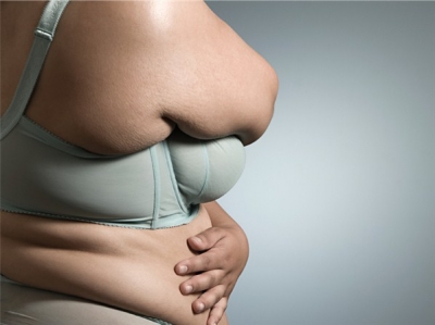 Obesidade eleva em até 40% risco de sete tipos de câncer em mulheres