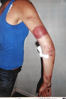 Cadeirante é preso após espancar sua esposa