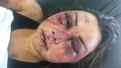 "Não morri porque sou forte, mas eu vivi o terror" diz Elaine Peres Caparroz 