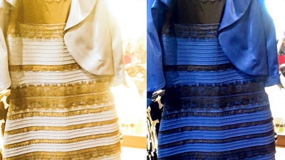 Mistério das cores do vestido pode ajudar a compreender doenças