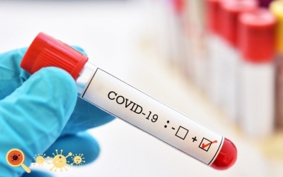 Covid-19: Marília soma 1.718 casos confirmados e 1 óbito suspeito