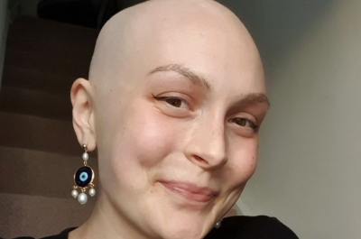 Após ignorar inchaço no abdômem por meses, jovem descobre câncer 