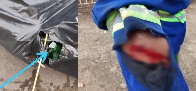 Coletor sofre corte grave na perna com vidro quebrado dentro de saco de lixo