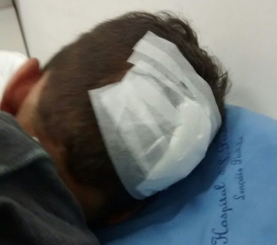 Menino de 5 anos com deficiência auditiva é espancado e precisou levar 10 pontos na cabeça.