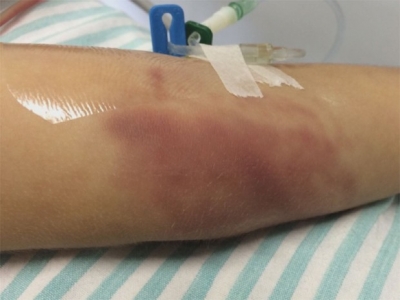 Mãe é presa suspeita de espancar filho de 5 anos