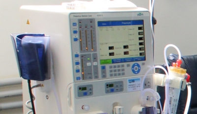 Nefrologia da Santa Casa de Marília atende 42,6% da demanda regional