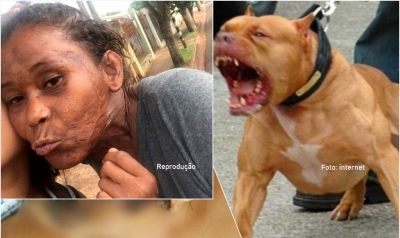 Morre no HC de Marília mulher atacada por cães da raça pitbull