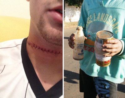 Motociclista fica ferido com linha de cerol