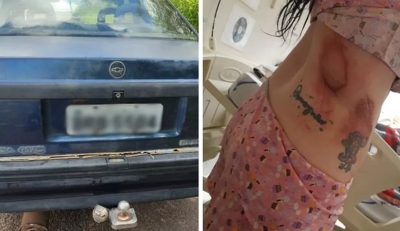 Mulher é amarrada em engate de carro e arrastada pelo ex-namorado