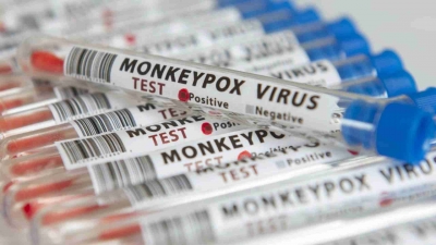 Vacina contra a varíola dos macacos deve chegar ao Brasil este mês